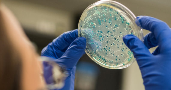 salmonella-kentucky-resistent-antibiotica