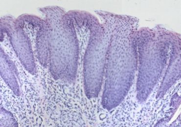 umami-kokumi-exhausteurs-gout