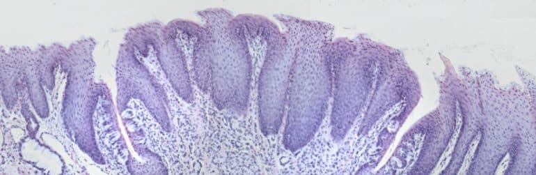 umami-kokumi-exhausteurs-gout