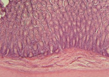 diabete-obesite-microbiote intestinal
