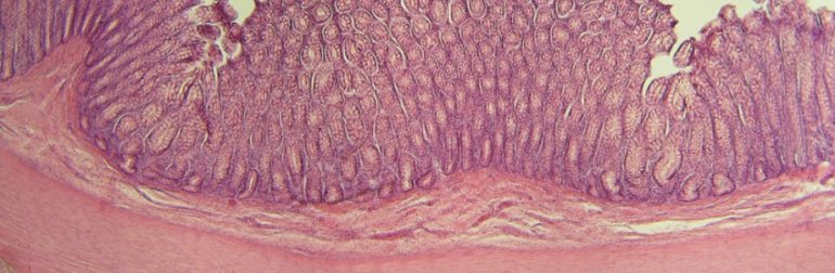 diabete-obesite-microbiote intestinal