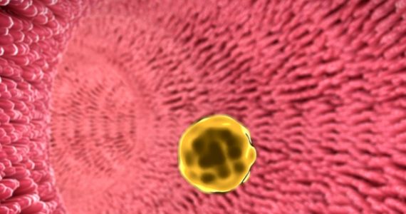 microbiote-lipides-sanguins