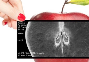 squelette-vitamine d-calcium