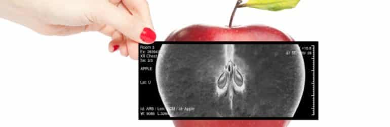 squelette-vitamine d-calcium