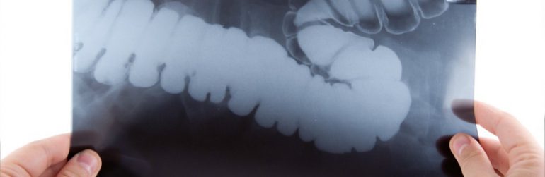 microbiome-pour-les-nuls