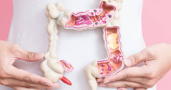 hoe-werkt-fodmap-dieet