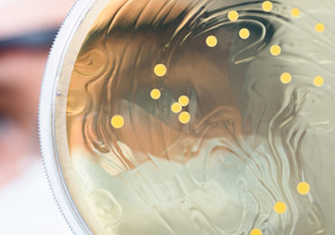 microbiote-obesite-signature-plasma