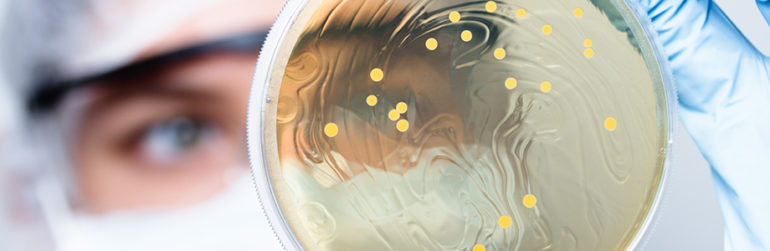 microbiote-obesite-signature-plasma