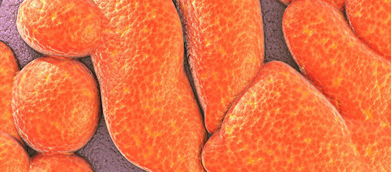 syndrome-métabolique-bactérie-intestinale-Bilophila-wadsworthia