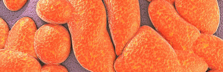 syndrome-métabolique-bactérie-intestinale-Bilophila-wadsworthia